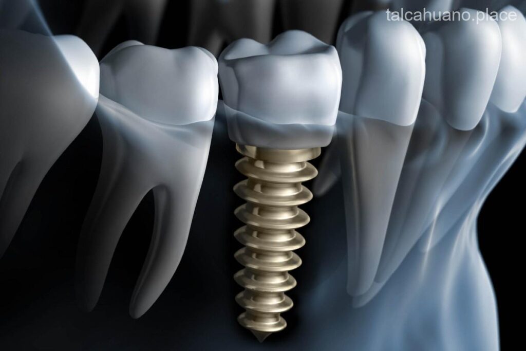 Los 5 mejores dentistas de implantes en Talcahuano