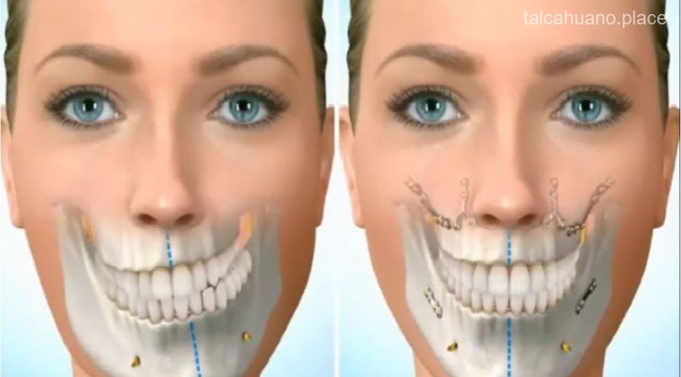 Los 8 mejores maxilofaciales de Talcahuano